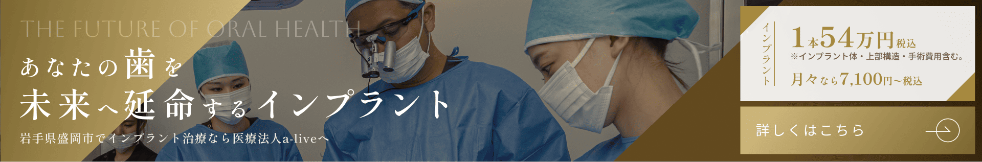 岩手県盛岡市でインプラント治療