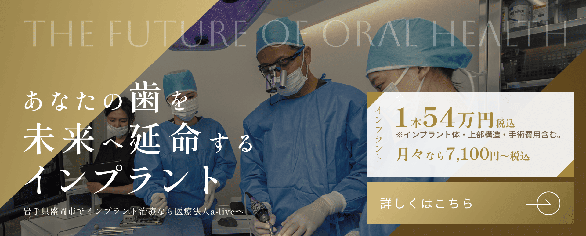 岩手県盛岡市でインプラント治療
