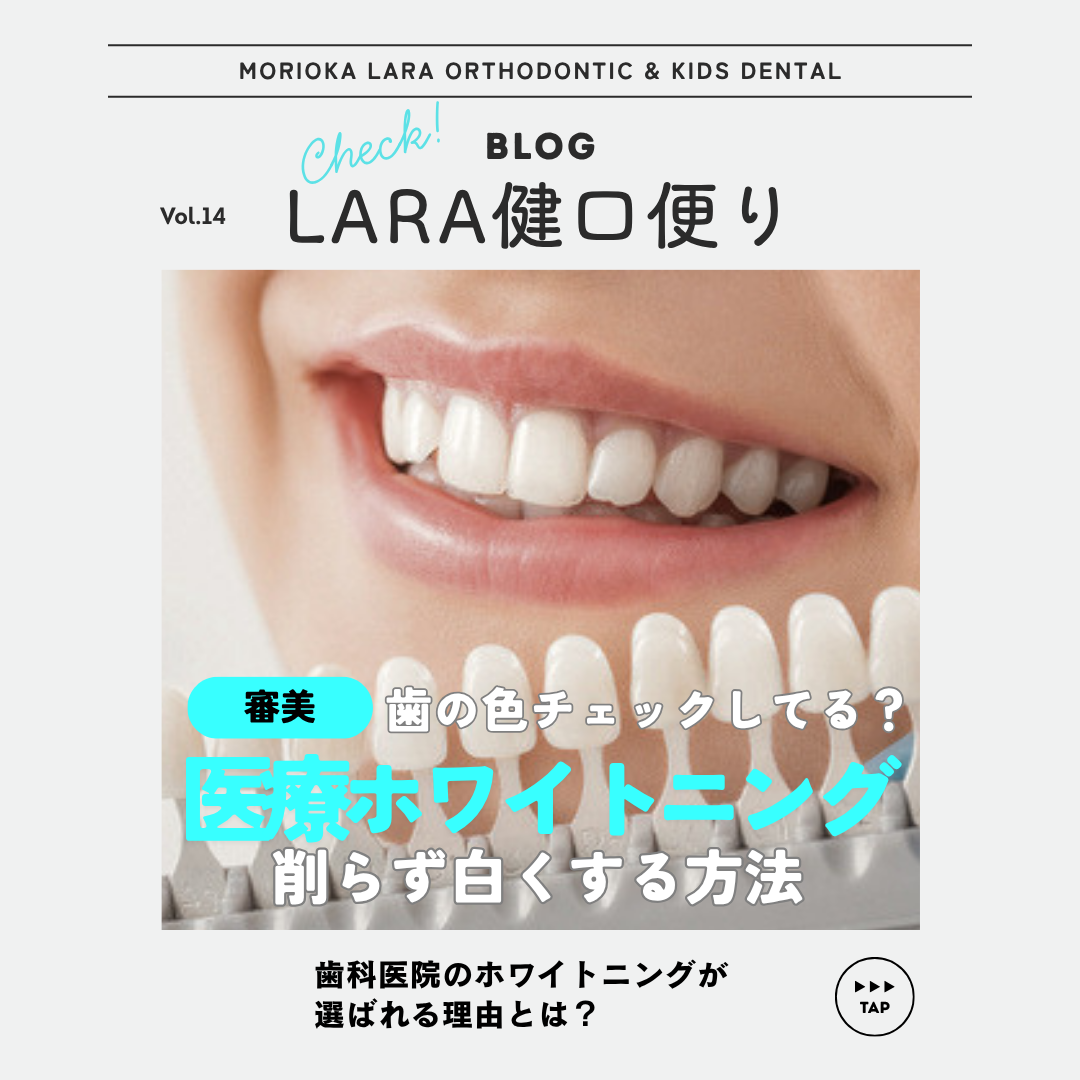 【LARA健口頼り vol.14】医療ホワイトニングのメリットとは？サロンとの違いと歯科医院で受ける安心ポイント