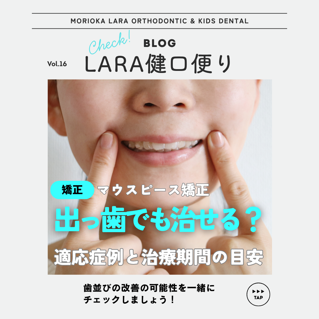 【LARA健口頼り vol.16】出っ歯が気になる方へ　マウスピース矯正で改善できるケースとは